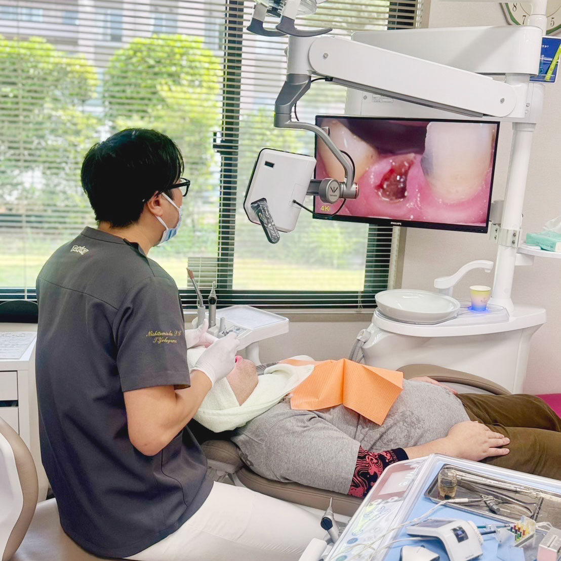 デジタルマイクロスコープ(NEXT VISION)